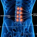VitaMotion Review: A Physical Therapist's Honest Opinion